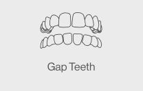 gap teeth